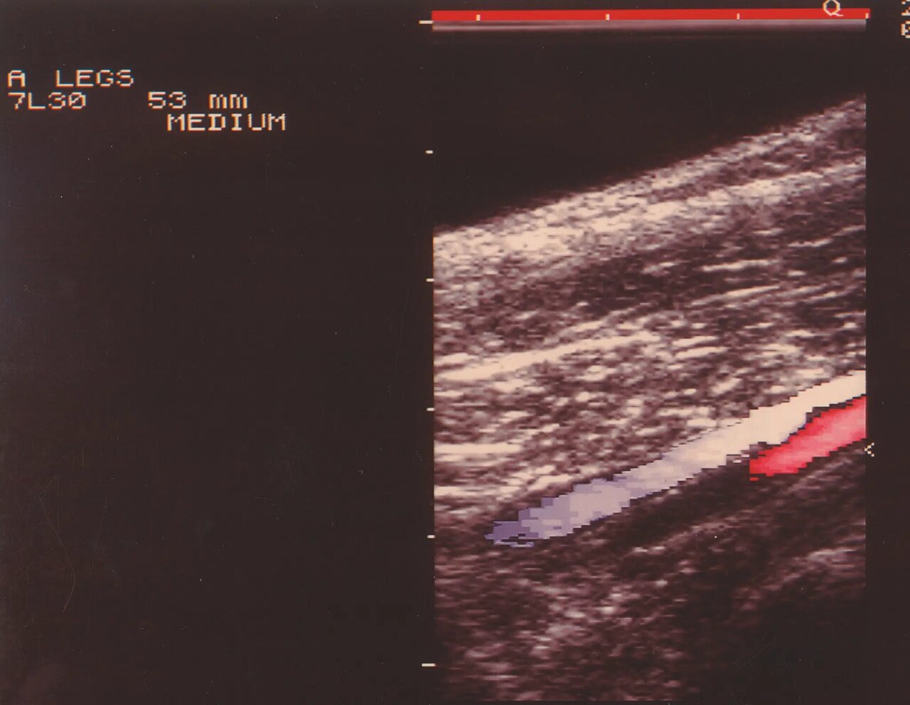 «سونوگرافی» چگونه کشف شد؟/ تصاویری از دستگاههای سونوگرافی در گذشت زمان