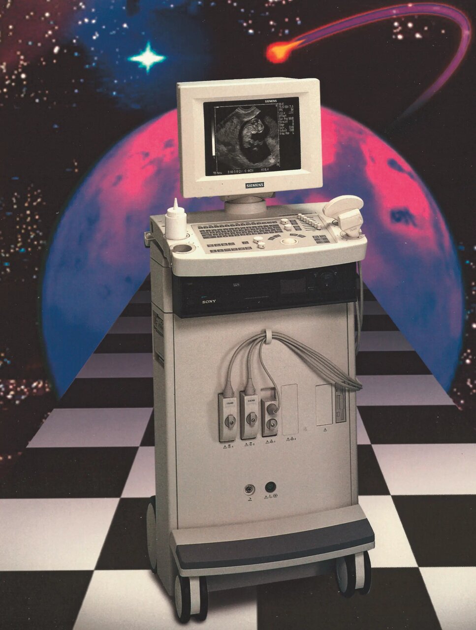 «سونوگرافی» چگونه کشف شد؟/ تصاویری از دستگاههای سونوگرافی در گذشت زمان