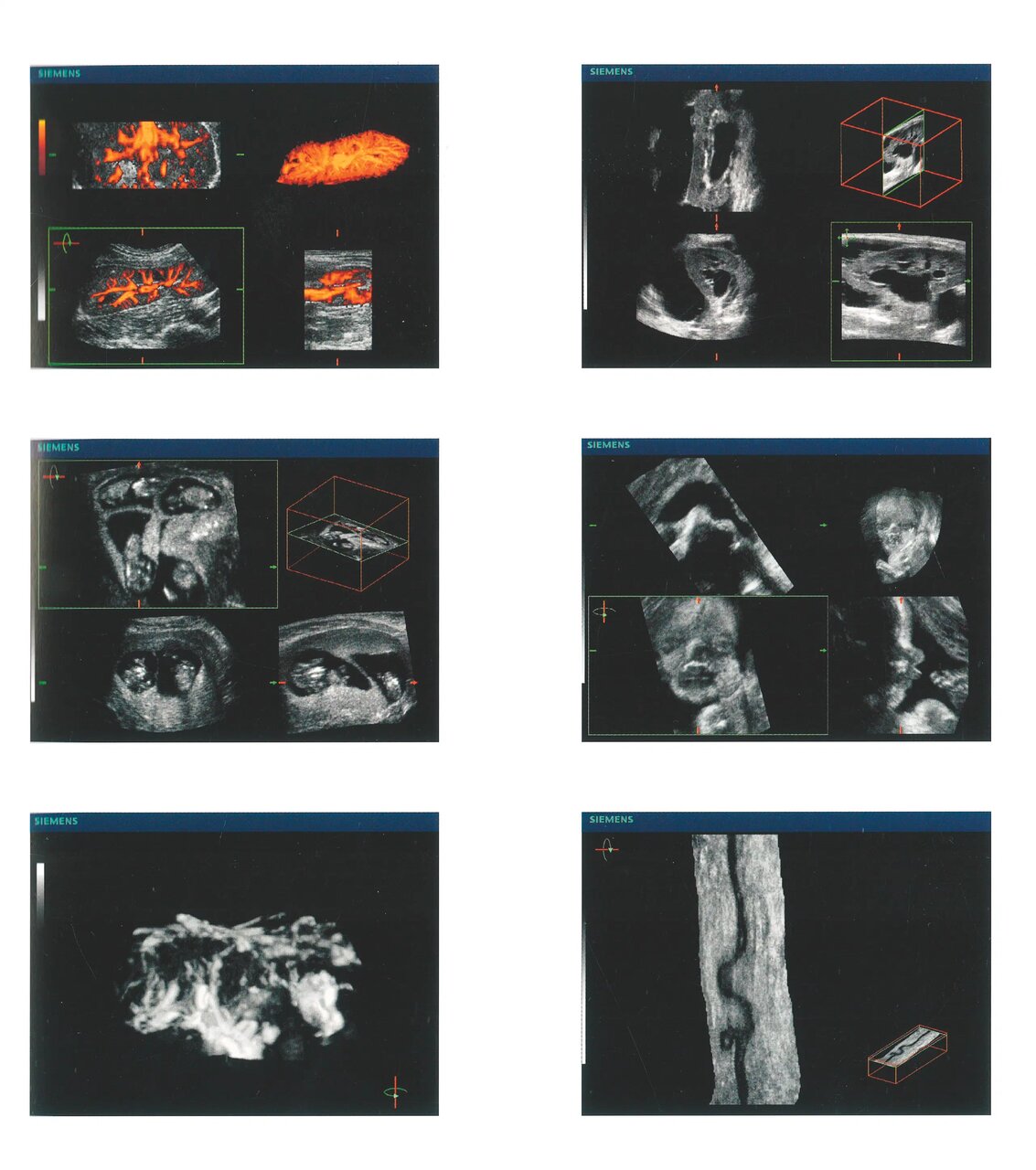 «سونوگرافی» چگونه کشف شد؟/ تصاویری از دستگاههای سونوگرافی در گذشت زمان