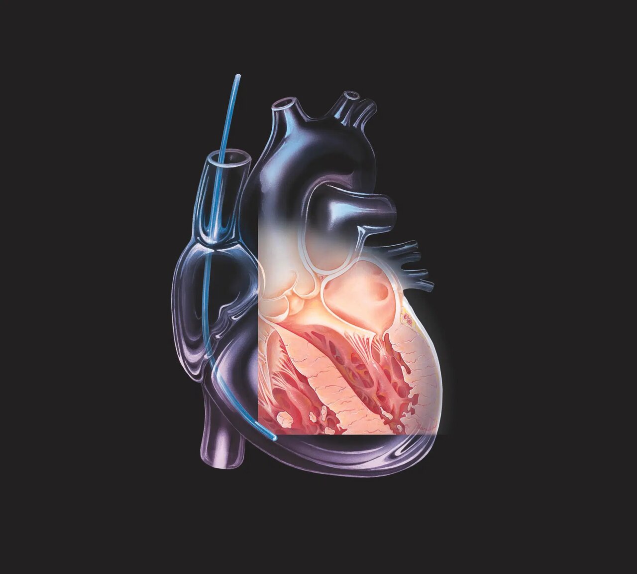 «سونوگرافی» چگونه کشف شد؟/ تصاویری از دستگاههای سونوگرافی در گذشت زمان