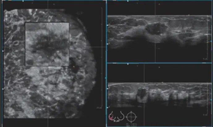 «سونوگرافی» چگونه کشف شد؟/ تصاویری از دستگاههای سونوگرافی در گذشت زمان