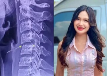 ماساژ گردن، خواننده تایلندی را به کشتن داد/ عکس ماساژ گردن، خواننده تایلندی را به کشتن داد/ عکس