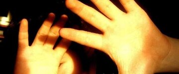 کمبود کدام ویتامین باعث حساسیت به نور می‌شود؟