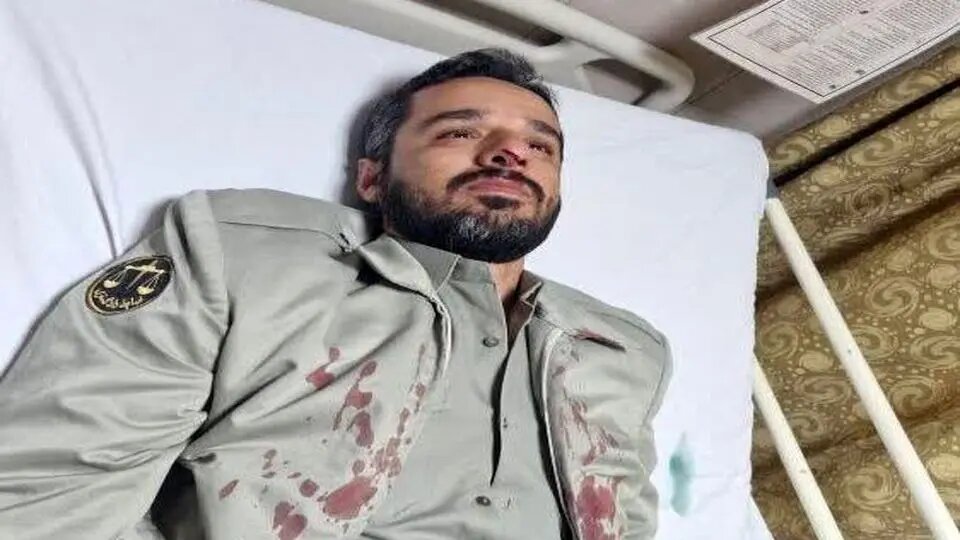 یک محیطبان برای محفاظت از بلوطها مجروح شد/ عکس