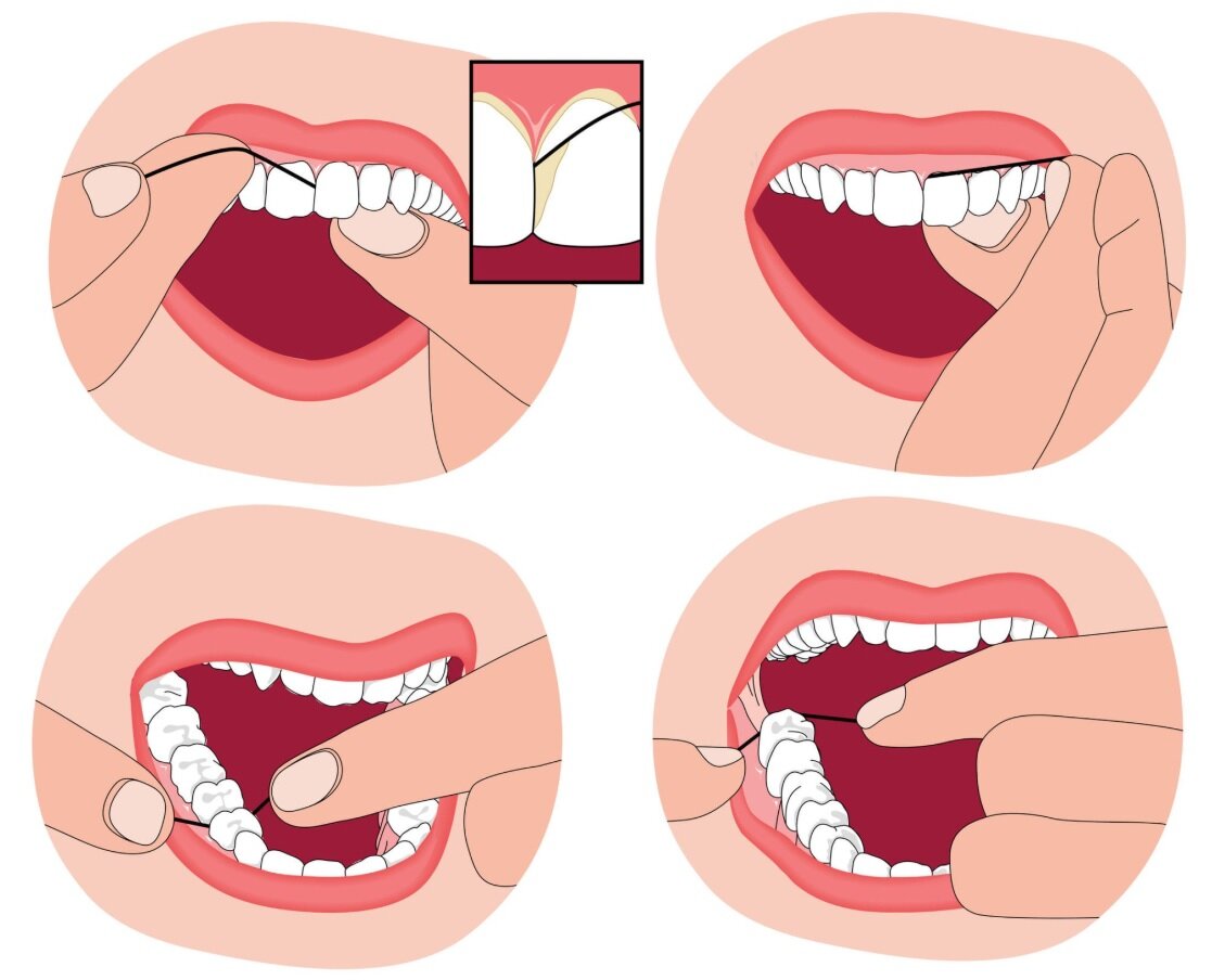 ۵ فایده نخ دندان/ چطور درست از نخ دندان استفاده کنیم؟