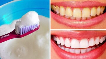 روشهای طبیعی سفید کردن دندانها روشهای طبیعی سفید کردن دندانها