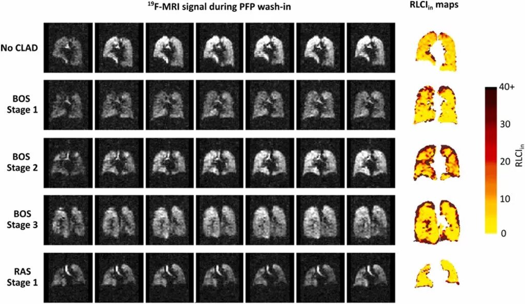 تماشای مسیر حرکت هوا در ریه بهصورت زنده / عکس
