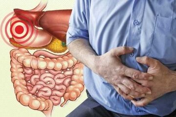 هشدار یک متخصص؛ شیوع یک نوع سرطان در ایران هشدار یک متخصص؛ شیوع یک نوع سرطان در ایران