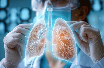 ریه اسفنجی چیست؟