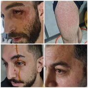 اتفاق عجیب در لیگ برتر والیبال: بازیکنان شهرداری ارومیه در گرگان کتک خوردند + عکس
