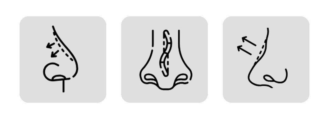 عمل زیبایی بینی با جراح متخصص