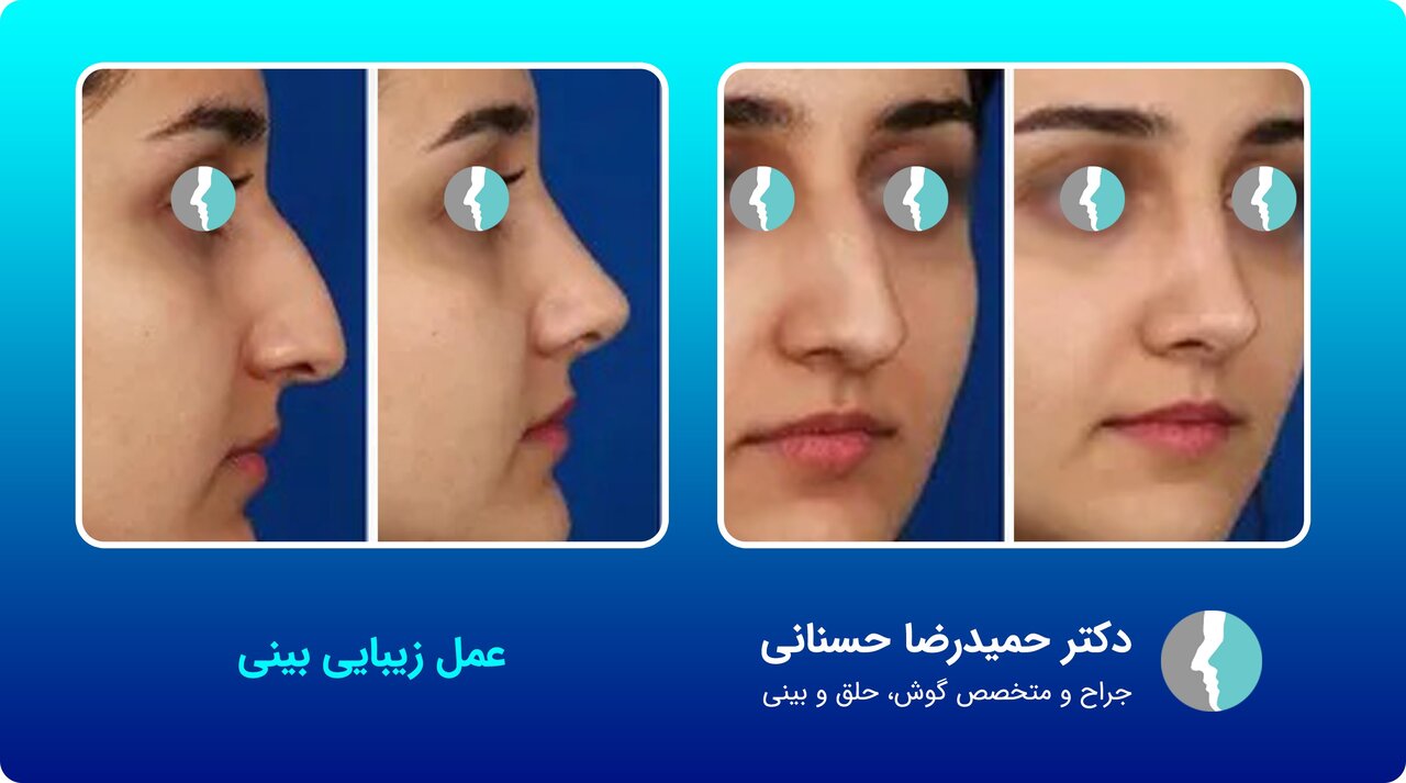 عمل زیبایی بینی با جراح متخصص