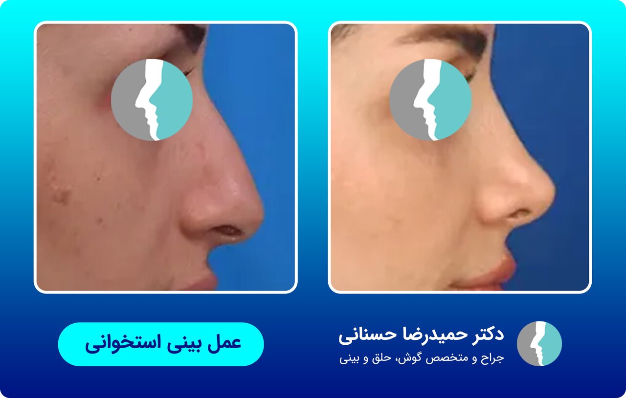 عمل زیبایی بینی با جراح متخصص