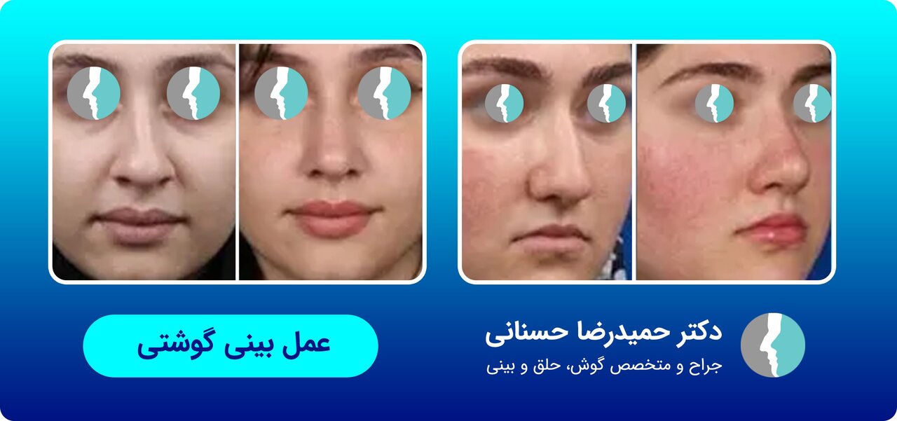 عمل زیبایی بینی با جراح متخصص