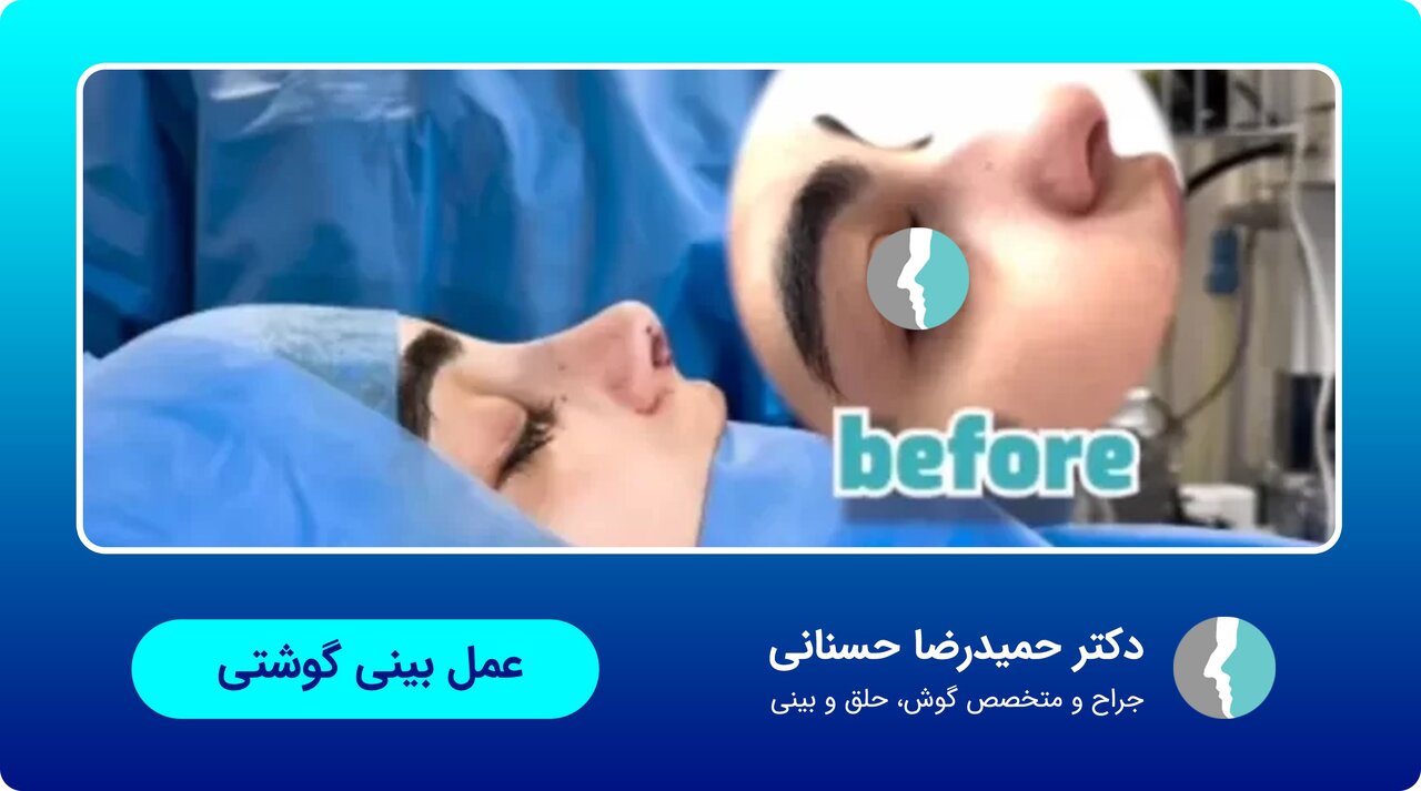 عمل زیبایی بینی با جراح متخصص