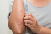 عادت‌هایی که پوست را نابود می‌کند