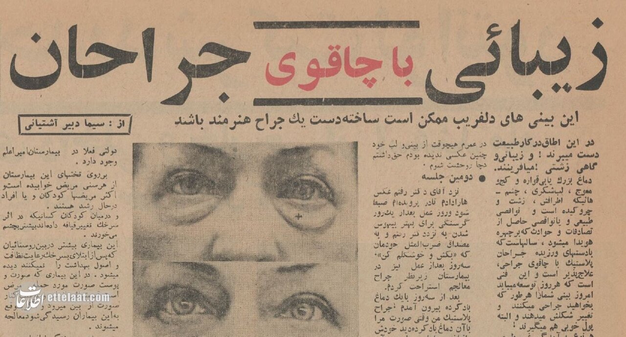 اولین جراحیهای زیبایی در تهران در کدام بیمارستان انجام شد؟/ عکس