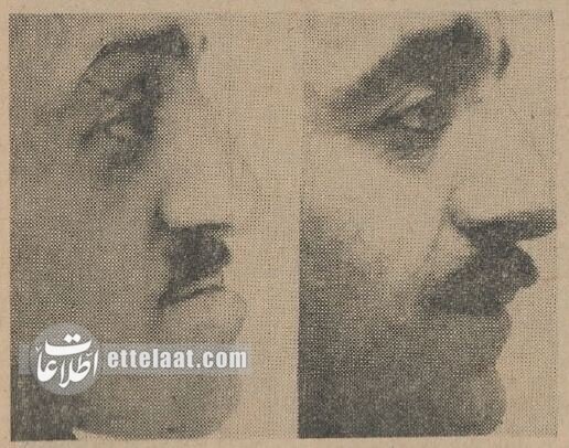 اولین جراحیهای زیبایی در تهران در کدام بیمارستان انجام شد؟/ عکس