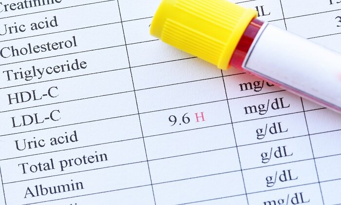 تا این رقم، اسید اوریک خطرناک نیست/ چند قلم از غذاهایی که به شدت اسید اوریک را افزایش میدهند/ لبنیات پرچرب خوب یا بد؟
