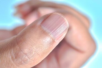 ژل ناخن کاری چه بلای سر دستتان میآورد؟ ژل ناخن کاری چه بلای سر دستتان میآورد؟