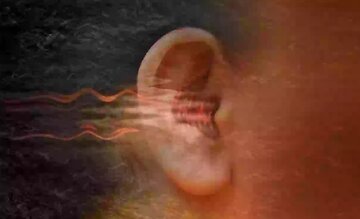 چرا گاهیاوقات گوشمان زنگ میزند چرا گاهیاوقات گوشمان زنگ میزند