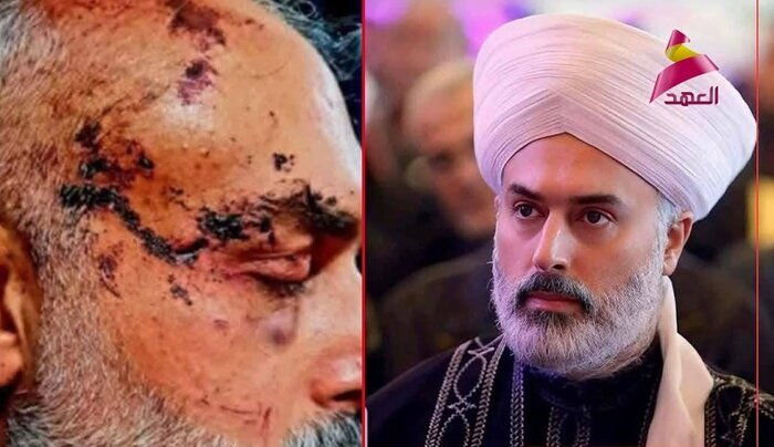 انفجار و درگیری در اطراف بیمارستان الوطنی/درع الساحل:پاسخ به جنایات حکومت،چندین برابر خواهد بود/کشته شدن یک روحانی اهل سنت/درگیریها به مرز عراق رسید