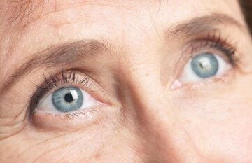 علایم پنهان آب مروارید که نباید آنها را نادیده گرفت علایم پنهان آب مروارید که نباید آنها را نادیده گرفت