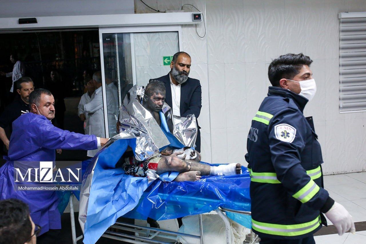 عکسی ترسناک از یک مصدوم چهارشنبهسوری امشب