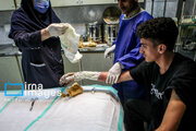 عجیب‌ترین تصویر از مصدومان چهارشنبه سوری امسال