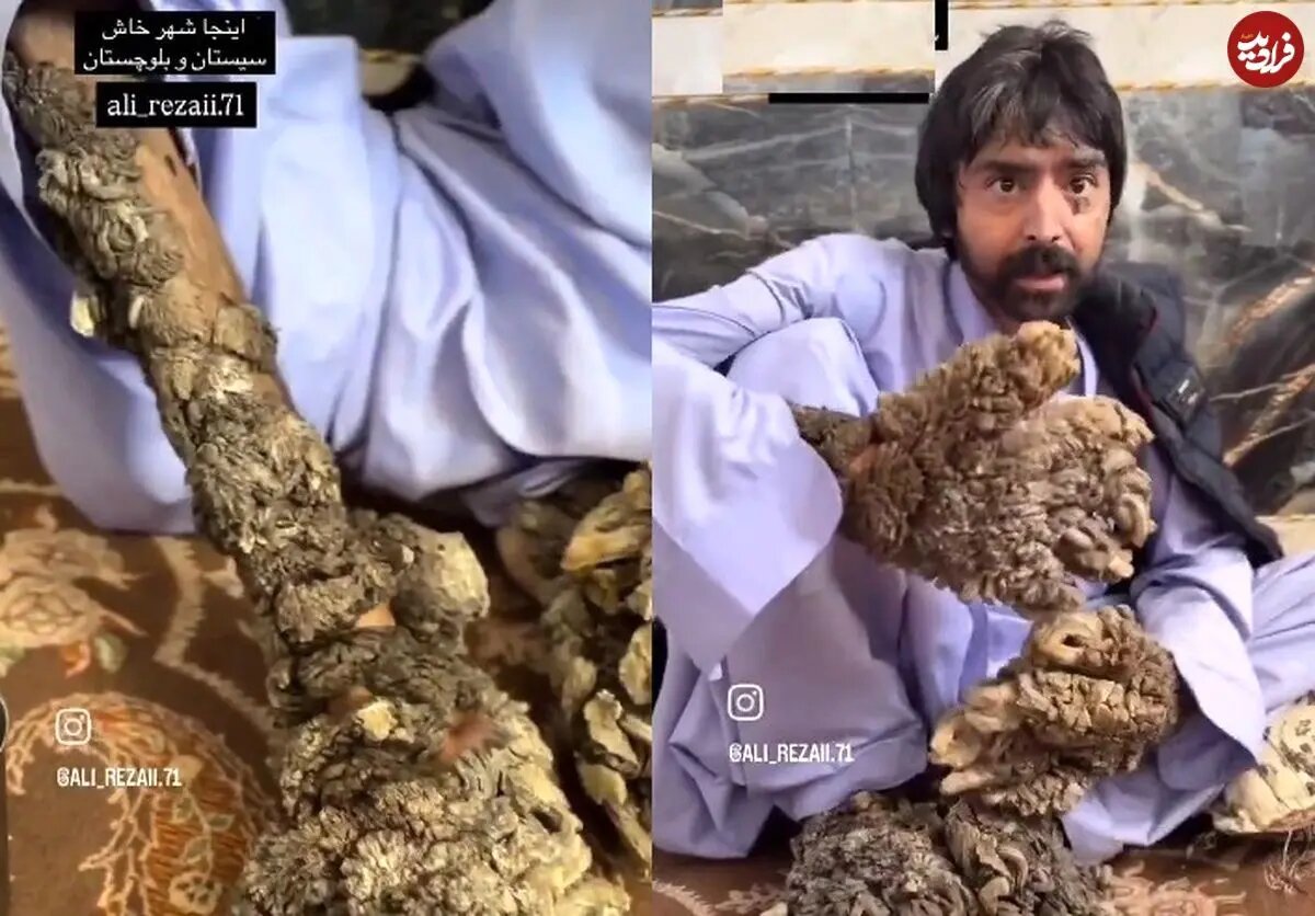 تصاویر دلخراش از مرد درختی ایران که وایرال شد/ بیماری او چیست؟