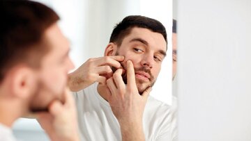 مهمترین نکاتی که باید برای از بین بردن آکنه بدانید مهمترین نکاتی که باید برای از بین بردن آکنه بدانید