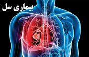 ۲۵ درصد بیماران مبتلا به سل در کشور، مهاجران افغانستانی هستند