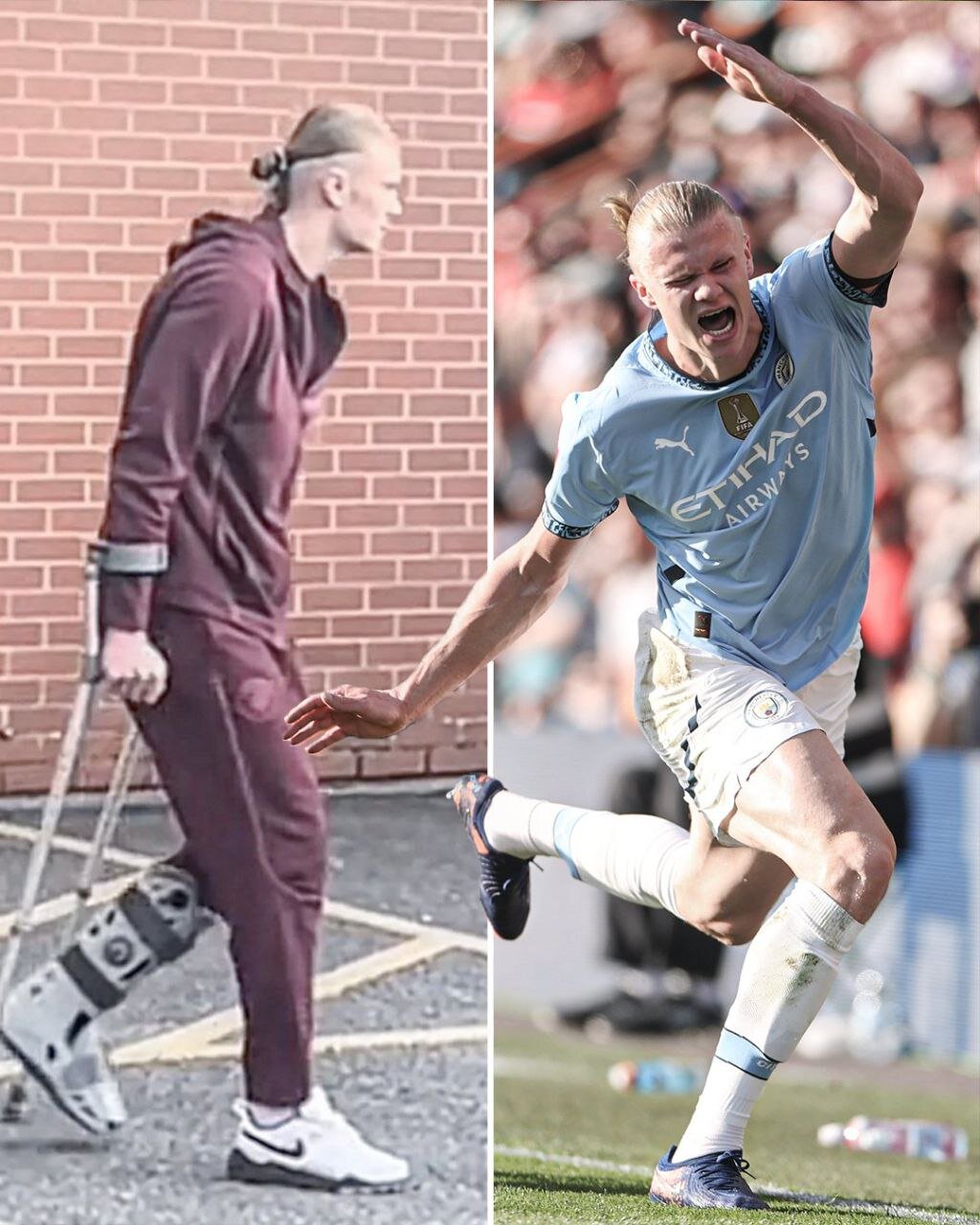 عکس | وضعیت نگرانکننده هالند پس از بازی منچسترسیتی