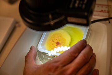 یافتن درمان مناسب برای سرطان با استفاده از تخم مرغ یافتن درمان مناسب برای سرطان با استفاده از تخم مرغ