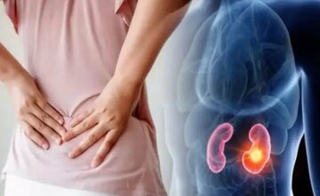 چه داروهایی برای کلیه پر خطر هستند؟ چه داروهایی برای کلیه پر خطر هستند؟