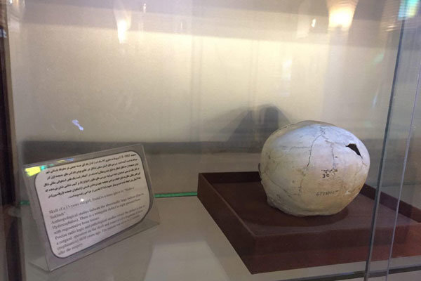 سیر تکامل جراحی مغز؛ از سنگ و مته تا رباتهای ناجی/ اولین جراحی موفق مغز به چه زمانی برمیگردد؟/ سوراخکردن مغز به قصد خروج ارواح خبیث!