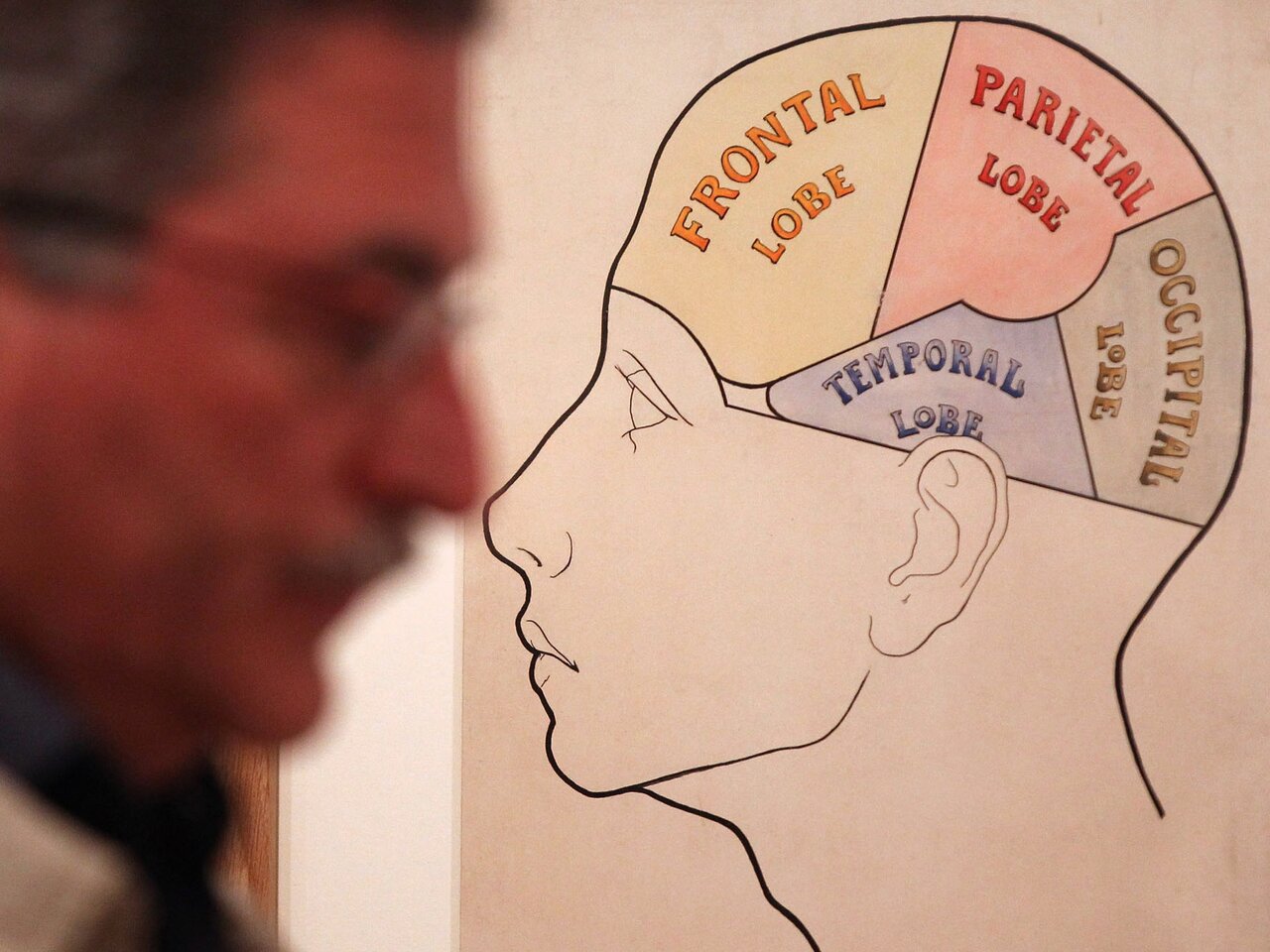 سیر تکامل جراحی مغز؛ از سنگ و مته تا رباتهای ناجی/ اولین جراحی موفق مغز به چه زمانی برمیگردد؟/ سوراخکردن مغز به قصد خروج ارواح خبیث!