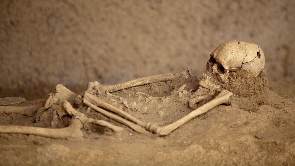 سیر تکامل جراحی مغز؛ از سنگ و مته تا رباتهای ناجی/ اولین جراحی موفق مغز به چه زمانی برمیگردد؟/ سوراخکردن مغز به قصد خروج ارواح خبیث!