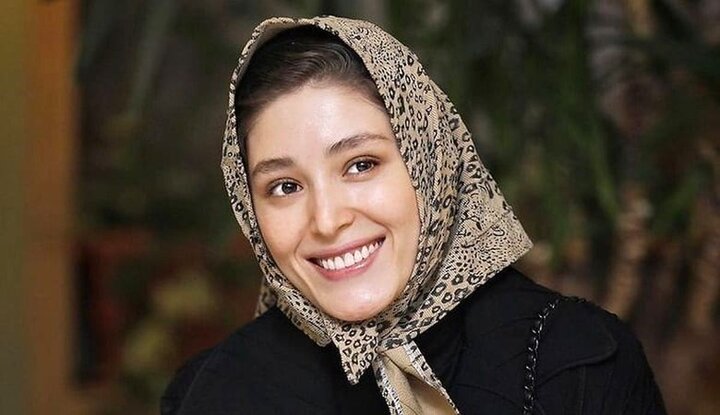 عکس | صورت کبود فرشته حسینی با چشم خون‌ریزی کرده!