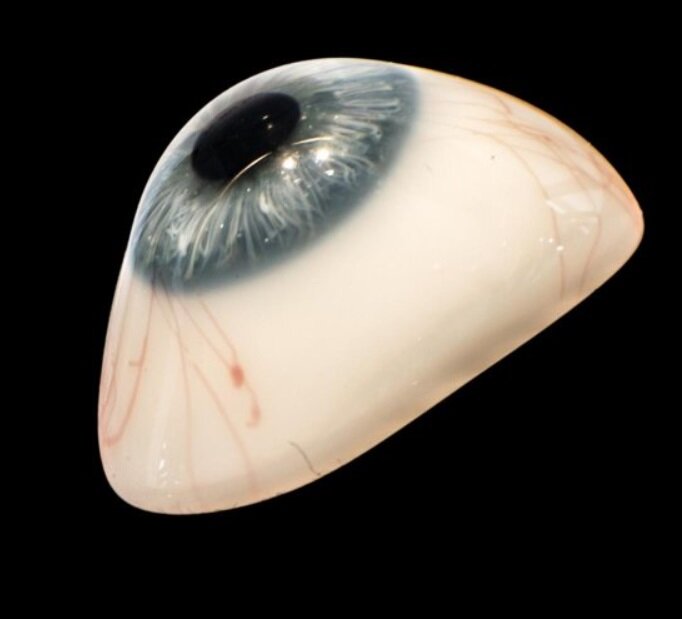 پیدا شدن یک چمدان با محتویات عجیب و باورنکردنی/ عکس