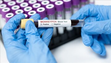 ویروس ام پاکس قربانی گرفت ویروس ام پاکس قربانی گرفت