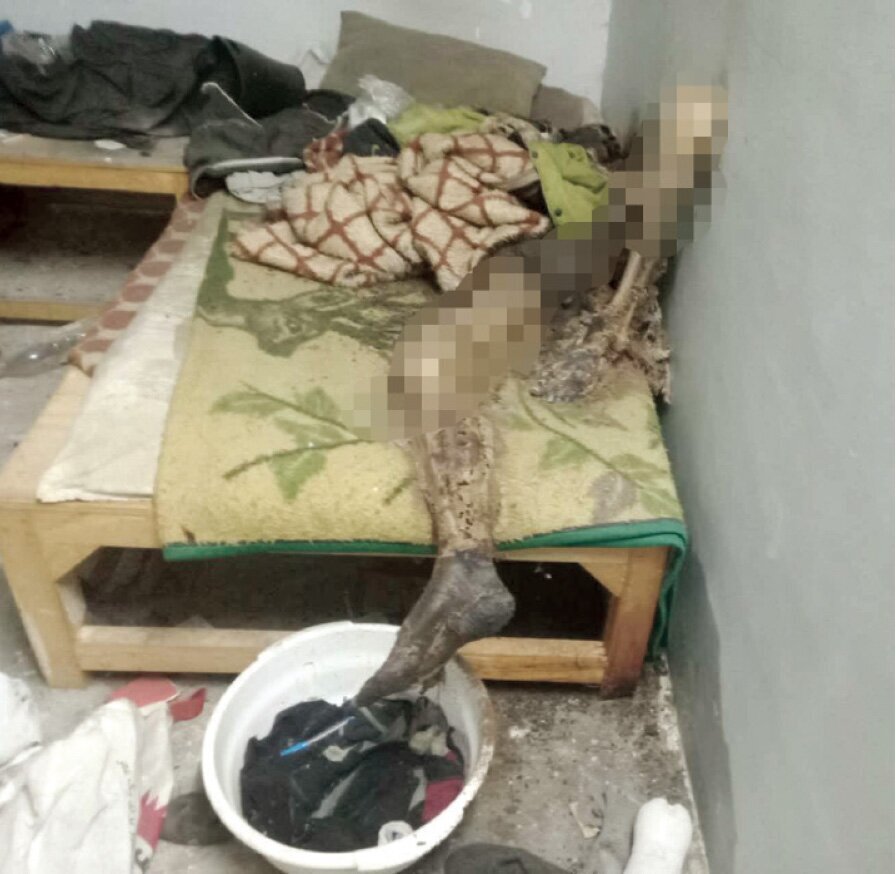 ماجرای تکان دهنده مردی که روی تختخواب اسکلت شد/ عکس