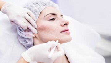 امبدینگ چیست و چطور باعث لاغری میشود؟ امبدینگ چیست و چطور باعث لاغری میشود؟