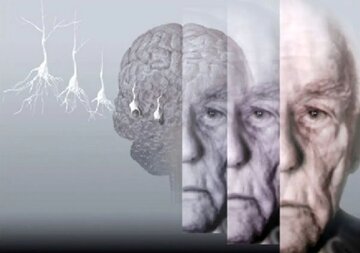 ۵ روش برای حفظ عملکرد مغز ۵ روش برای حفظ عملکرد مغز