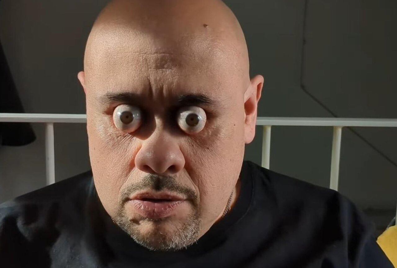 مردی که با چشمان از حدقه بیرونزده رکوردهای گینس را جابهجا کرد/ عکس