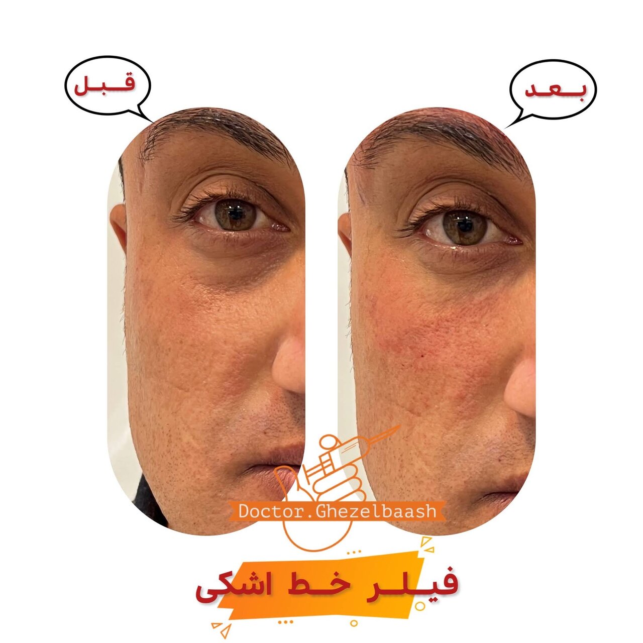 کلینیک زیبایی دکتر سعید قزلباش در کرمانشاه