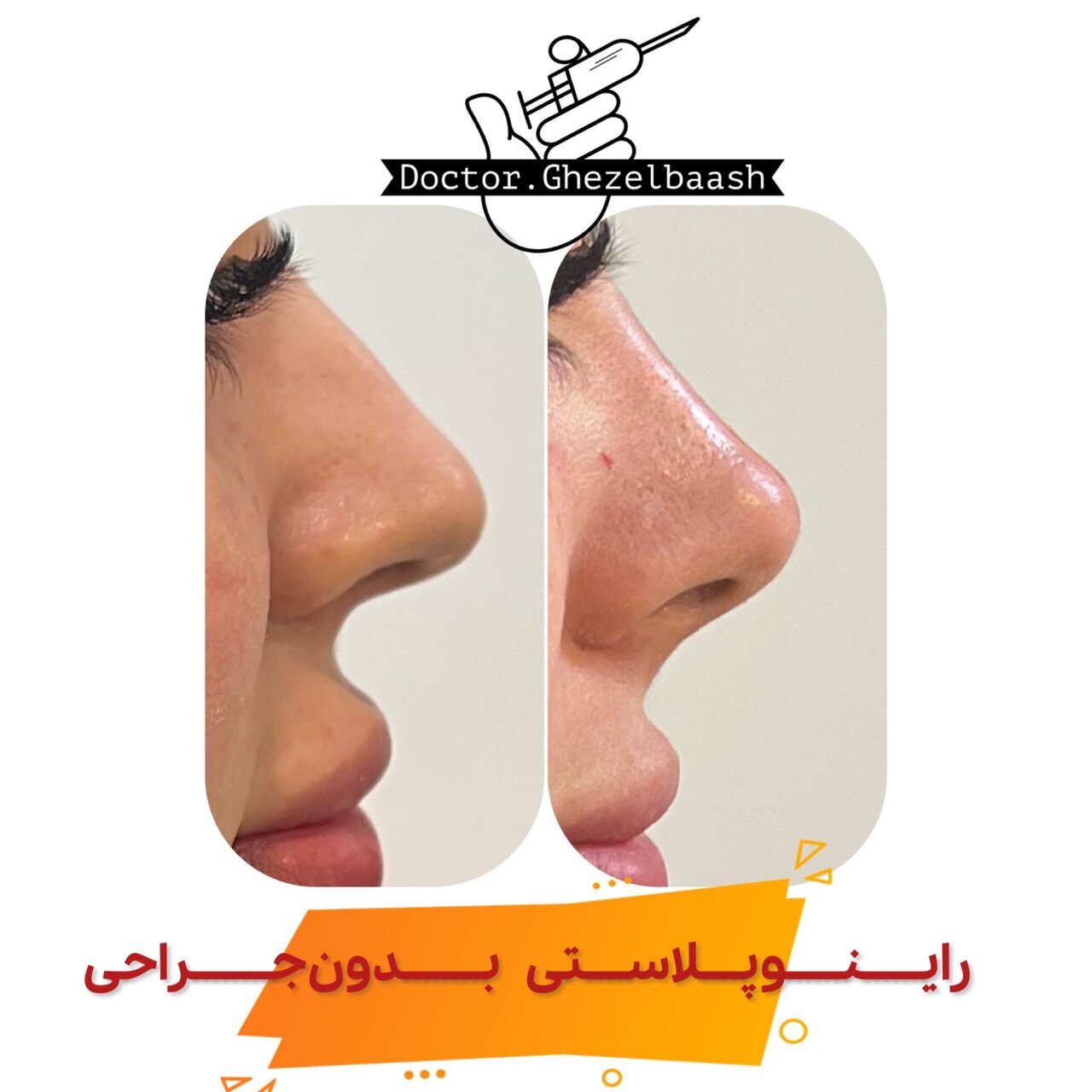 کلینیک زیبایی دکتر سعید قزلباش در کرمانشاه