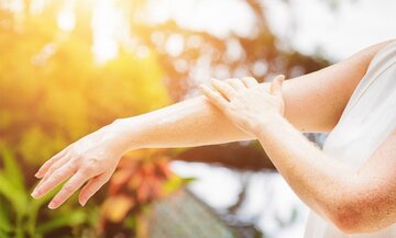 هشدار درباره خطر اشعه خورشید هشدار درباره خطر اشعه خورشید