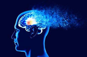 چرا برخی از افراد در میانسالی به زوال عقل مبتلا می‌شوند؟