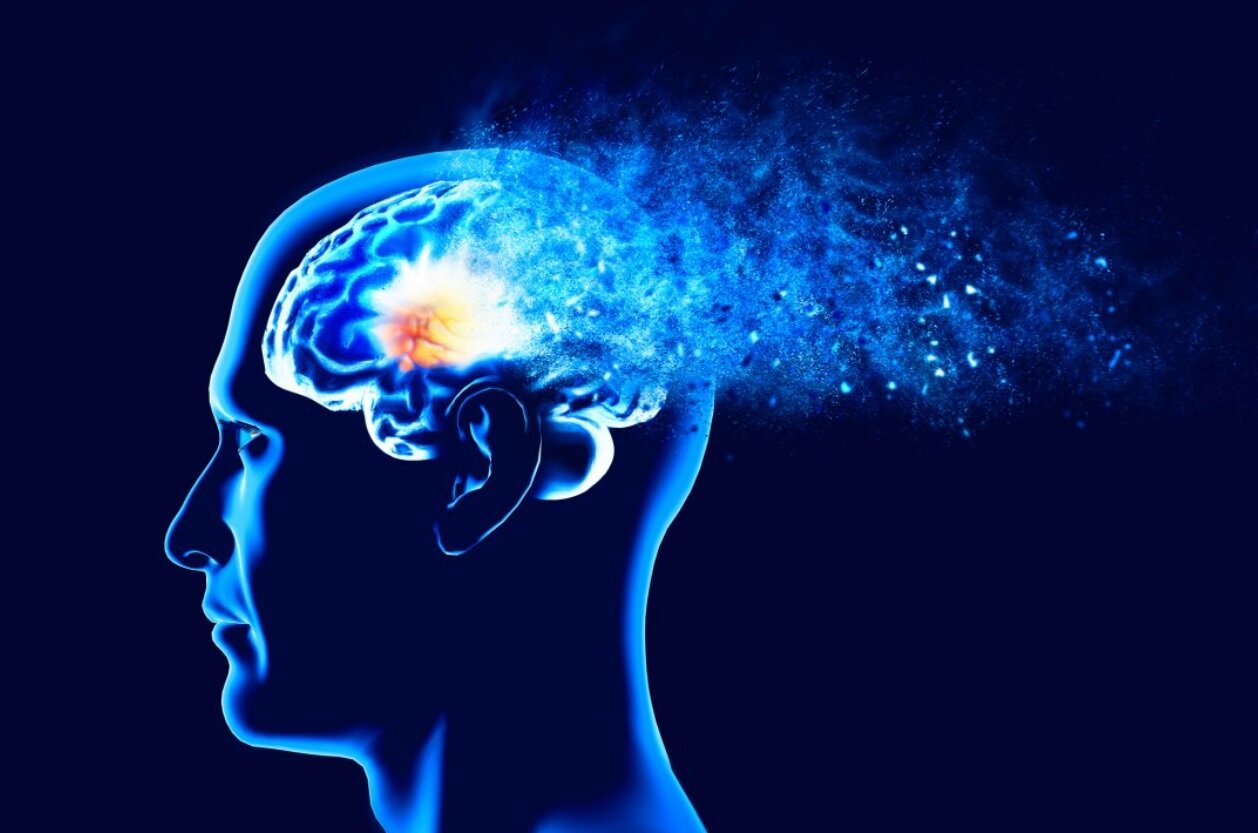 تشخیص ۹ نوع زوال عقل فقط با یک اسکن